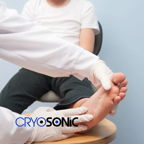 Are you looking for fast effective wart removal Contact us today Weston-Super-Mare